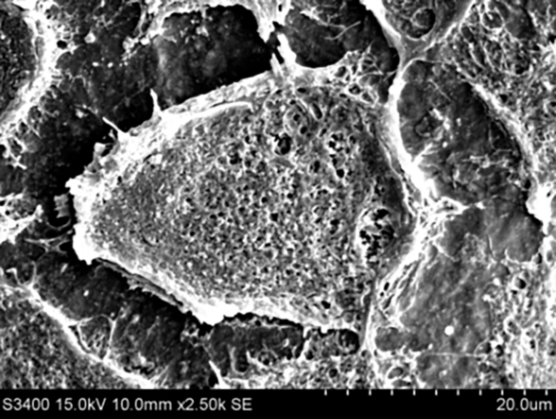 Mesenchymal cell on HA composite