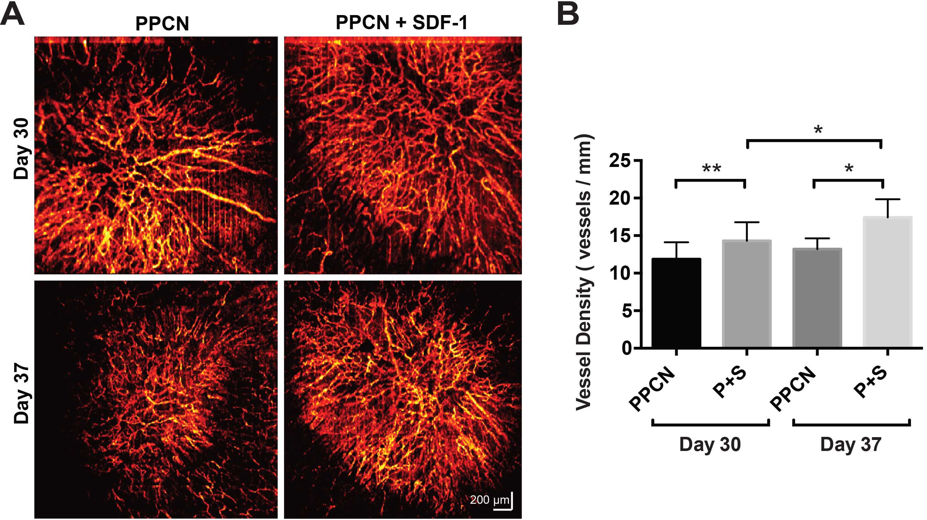 Wound microangiography of diabetic wounds treated with hydrogels, displaying sustained greater angiogenesis in the wounds treated with protein-releasing hydrogel.